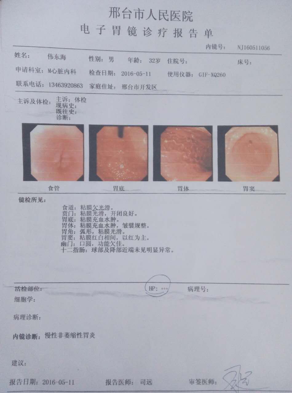修正唯达舒 老胃病患者的福音